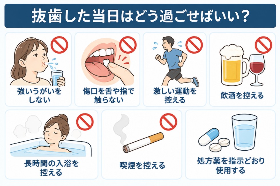 抜歯後の注意点